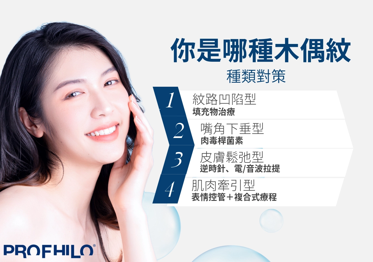 你的木偶紋屬於哪一種類型