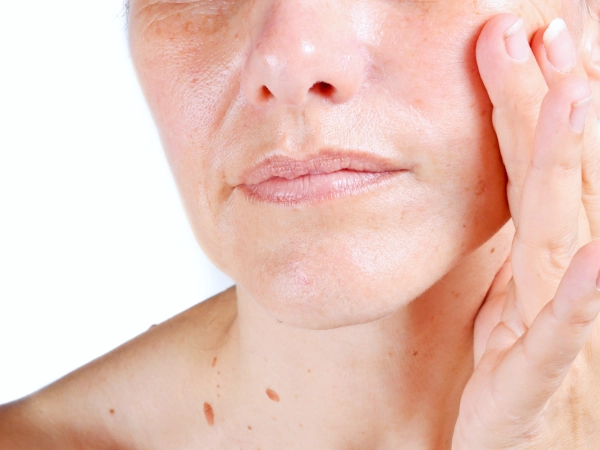 線條不算深,但臉整體往下掉的法令紋