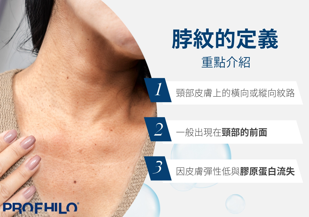 脖紋是什麼？