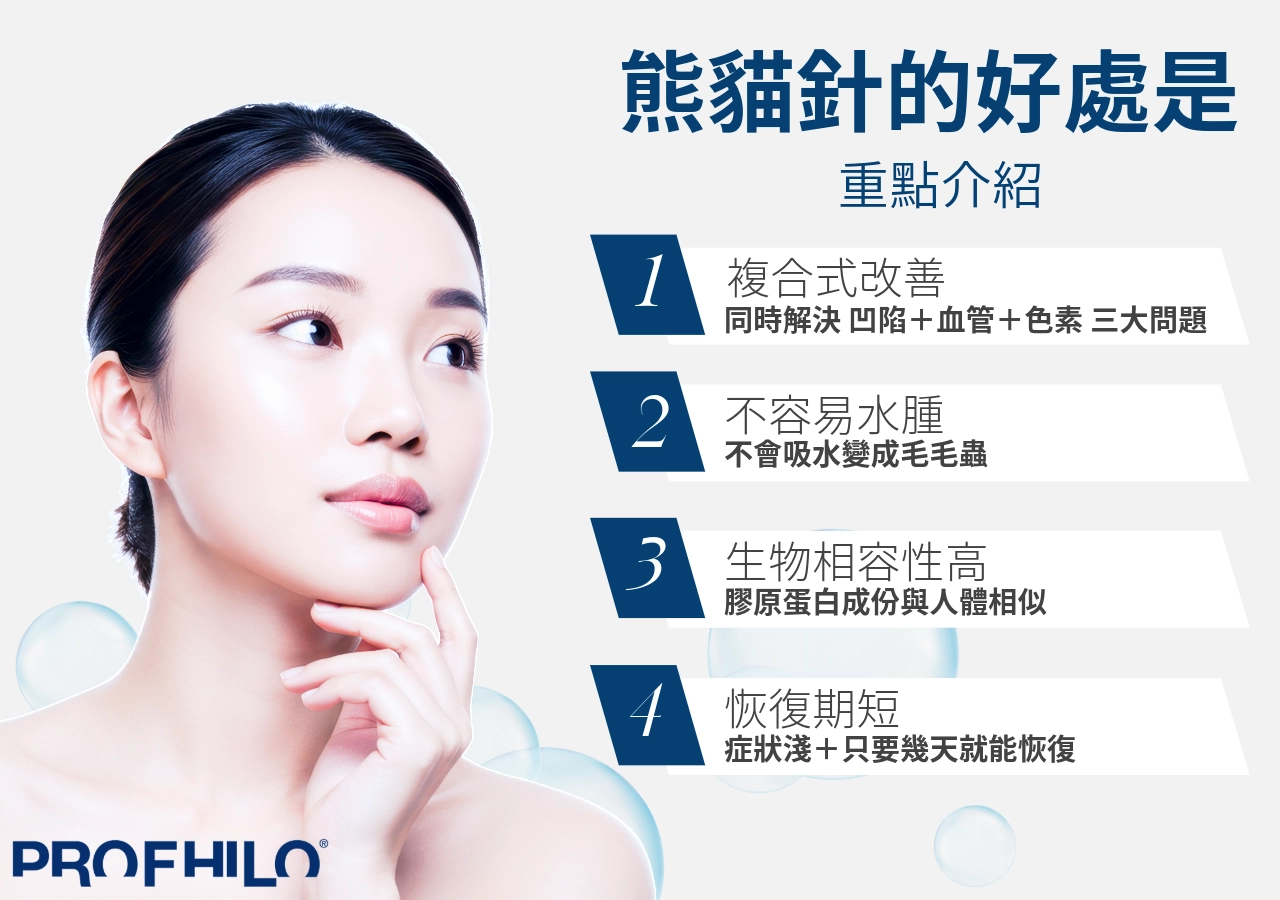「熊貓針」的優勢與適合對象