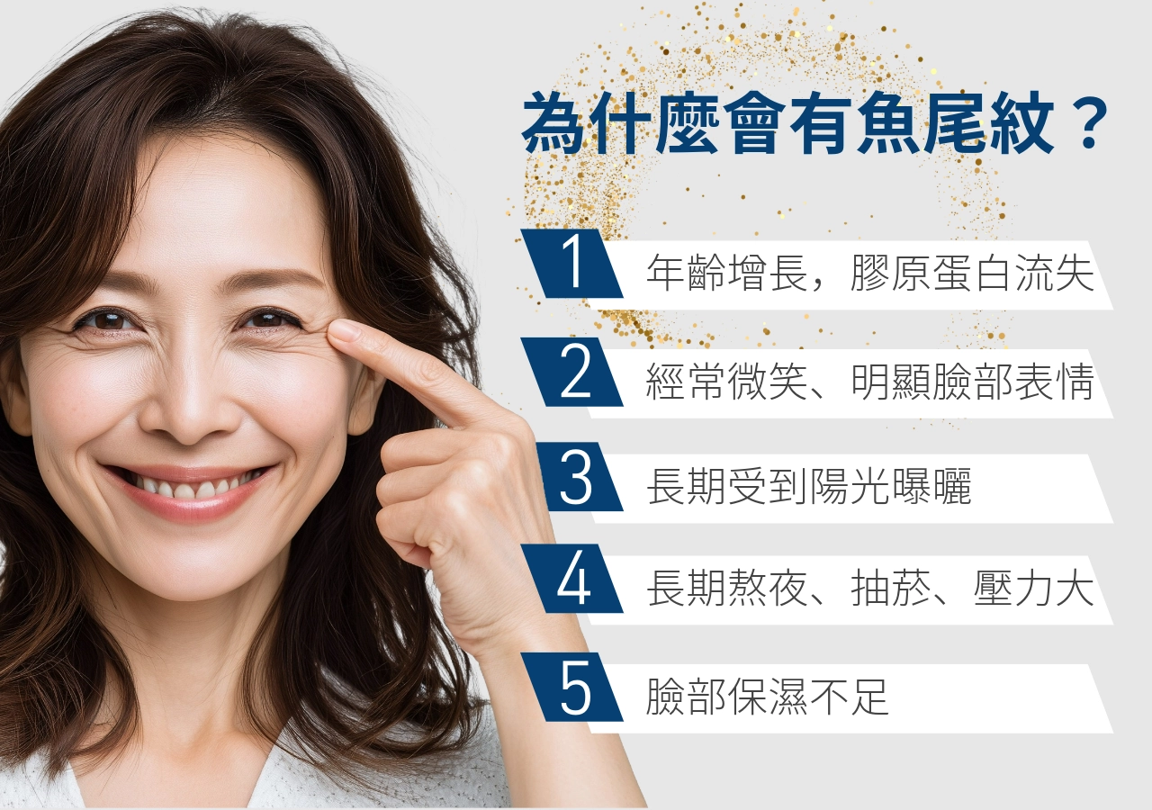 為什麼會有魚尾紋？