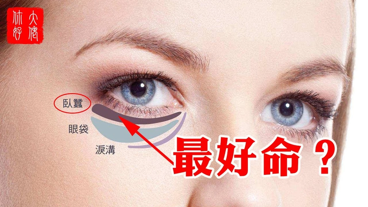 臥蠶和淚溝、眼袋差別