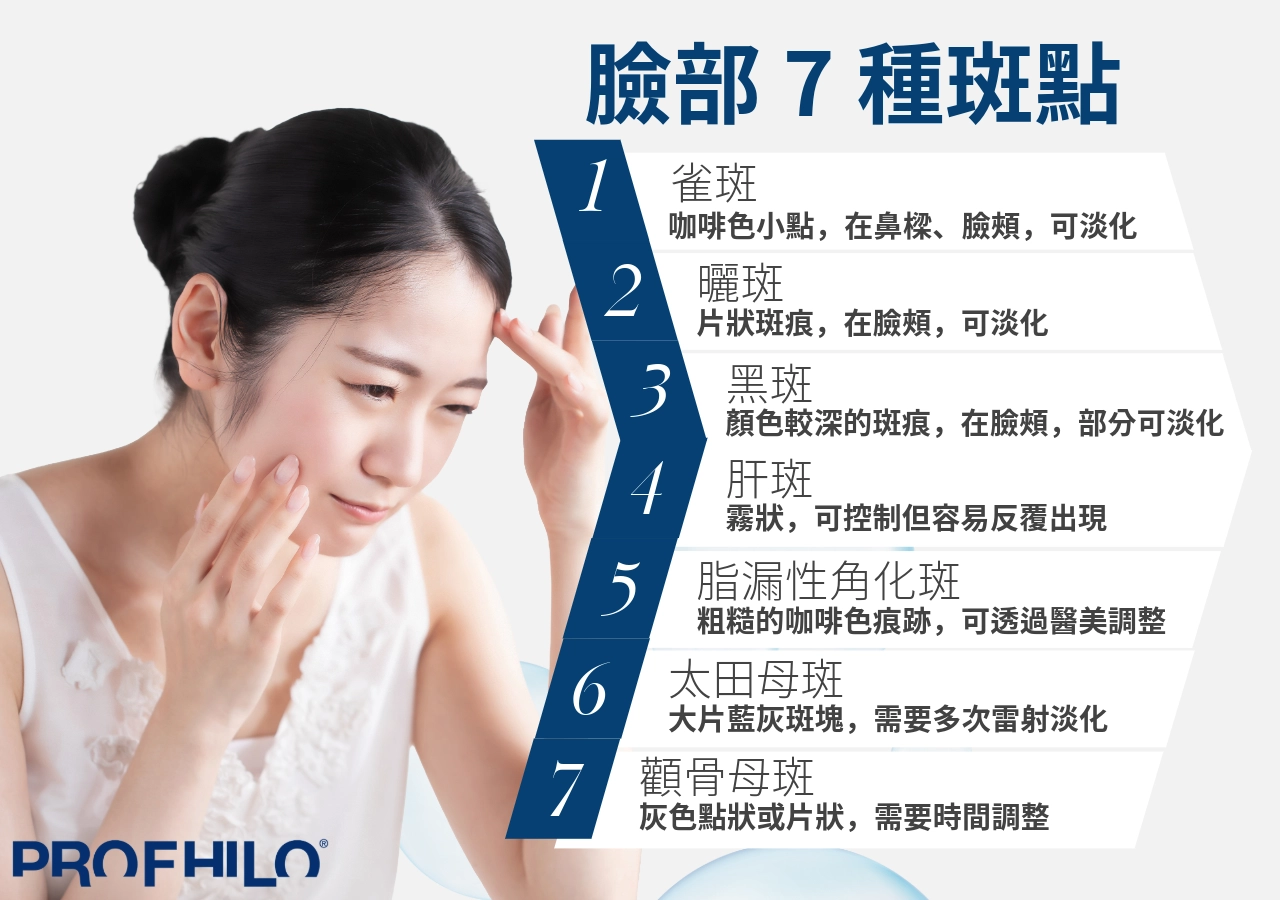 臉部七種斑點