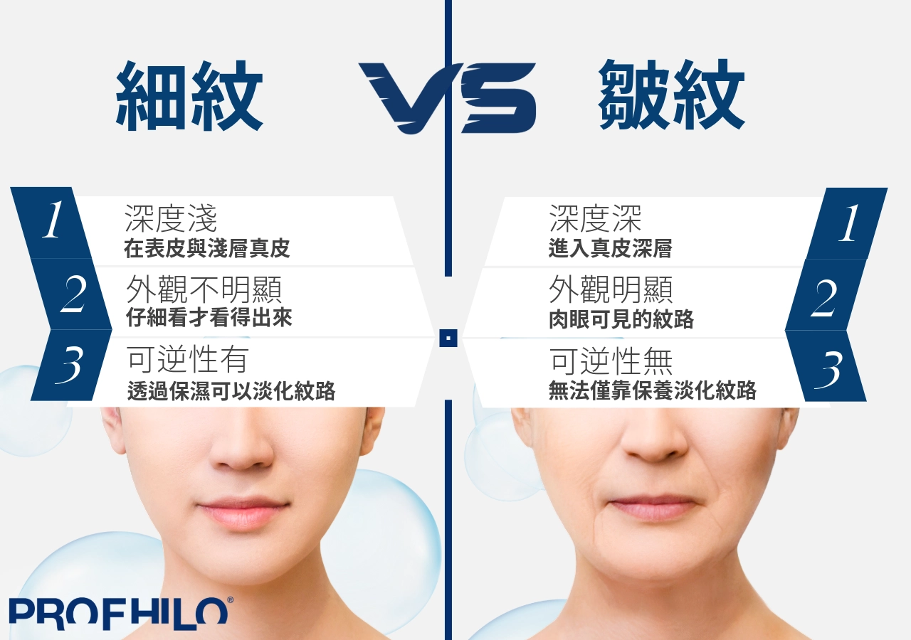 細紋與皺紋差別