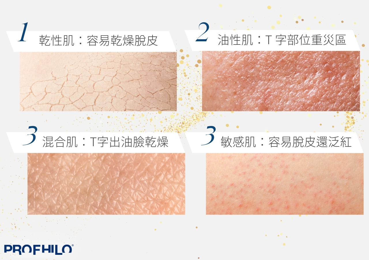 四種膚質介紹：乾性、油性、混合性、敏感性