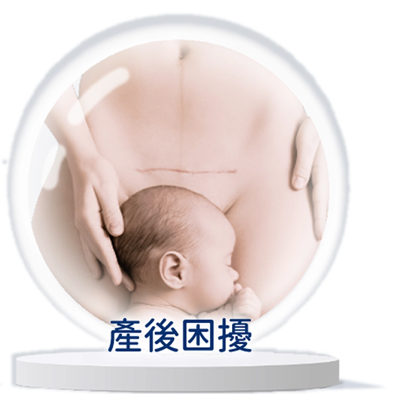 產後困擾