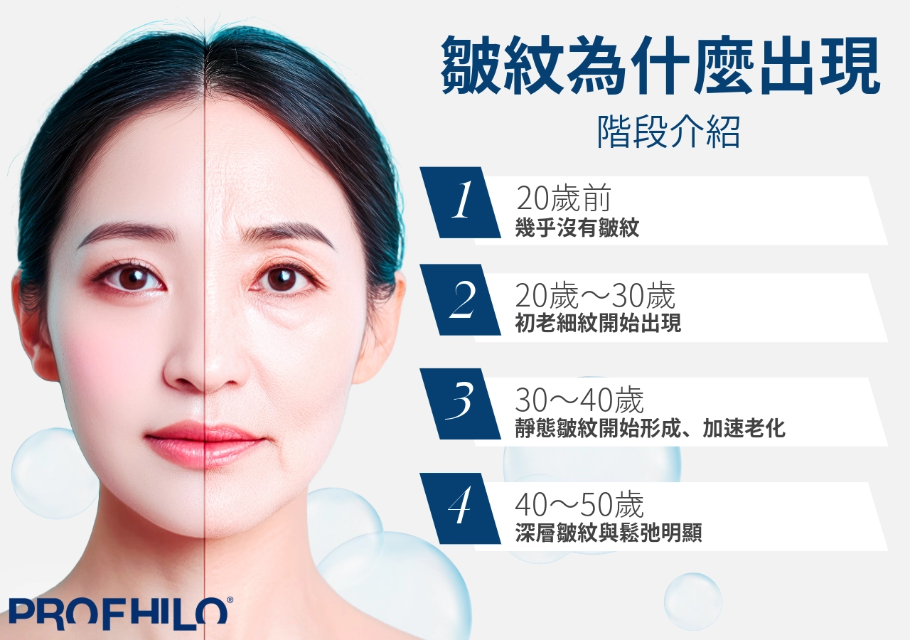 為什麼皺紋會出現