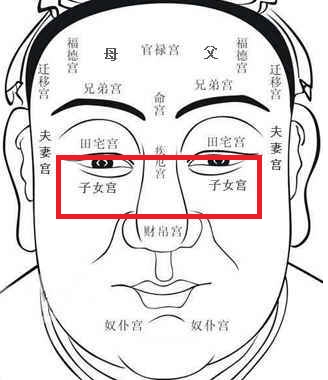 臥蠶的位置就在下眼瞼,也被稱作「子女宮」